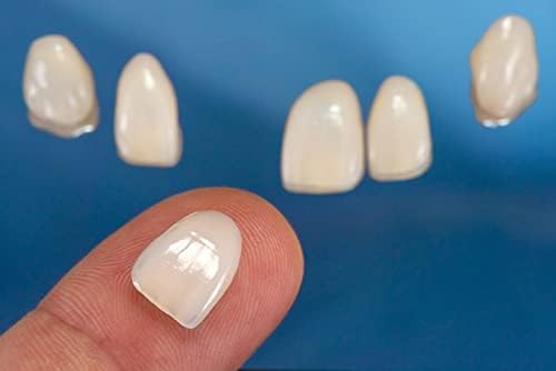 Импресивна насмевка Ултра тенки фурнири за белење на забите | Козметички реалистично решение во потрага по исчезнати или скршени
